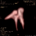 eft-ossicles7
