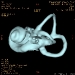 inner-ear-left3