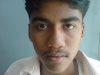 3-pre-op-rhinoplasty