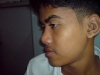 6-post-op-rhinoplasty