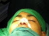 splints2