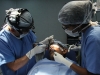 coblation-turbinoplasty1