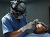 coblator-turbinoplasty