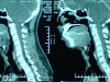 ct-pn-ratio5