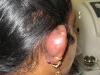 10-complication-ear-piercing4