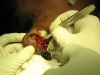 12-operation1
