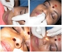 22-nose-piercing-in-minor-ot
