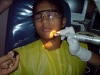 laser-facial-mole
