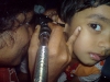otoscopy2