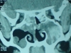 afs1