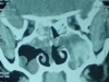 afs2