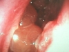 afs