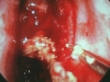 afs2