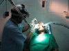 co2-laser-treatment-for-sneezing1