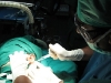 7-laser-keloid