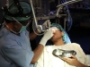 laser-nasal-allergy-003