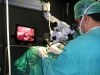 mastoid exploration