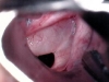 polyp_0