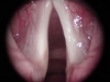vc2