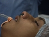 surgery-over