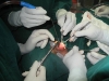 rhinoplasty6
