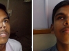 pre-and-post-op2