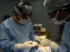 rhinoplasty-procedure1