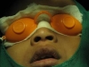 after-surgery2