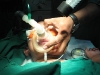anesthesia-by-mask
