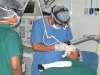 laser-facial-mole