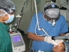 laser-facial-mole2
