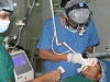 laser-nasal-mole