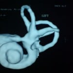 3DCT paulossign7