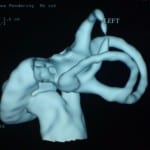 3dCT paulosign5
