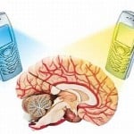 44 brain radiation 44 brain radiation