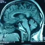 MRI 1 MRI 1