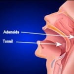 adenoid tonsil