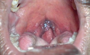 blue uvula 3