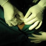 fracture nasal bone closed reduction fracture nasal bone closed reduction