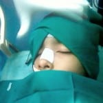 fracture nose fracture nose