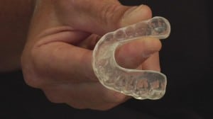 gum shield