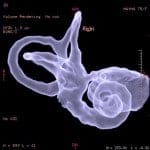 inner ear