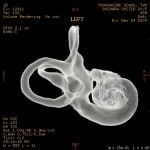 inner ear 6
