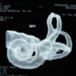 inner ear of child inner ear of child