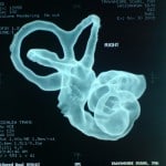 inner ear3