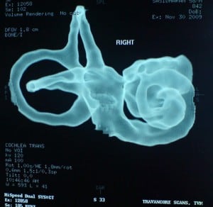 inner ear4 inner ear4