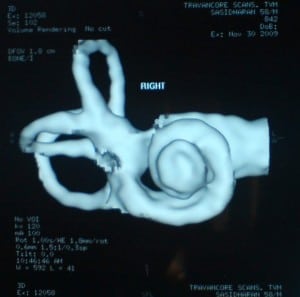 inner ear6 inner ear6