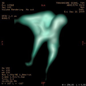 innerossicles-19