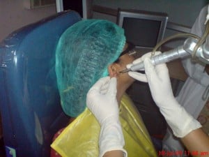 laser surgery ear3