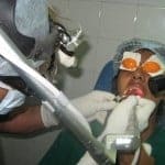 laser throat laser throat